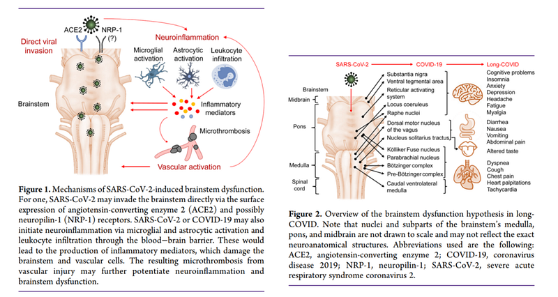 Visual representation of long-COVID biological causes