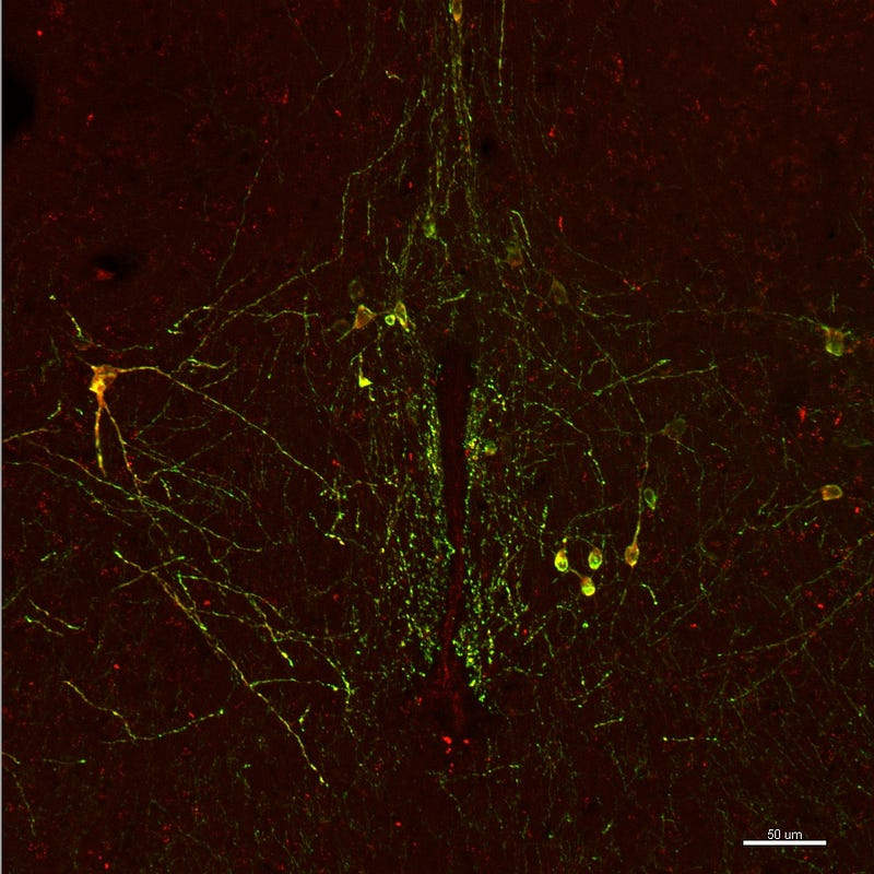 Neurons highlighting the complexity of knowledge