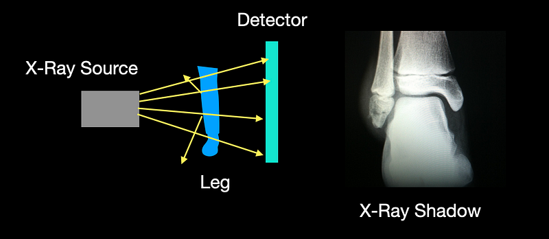 Diagram illustrating how an x-ray image is generated