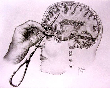 Illustration of brain anatomy