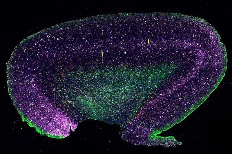 Visual representation of Alzheimer's and the quest for understanding AI.